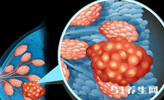 每天早晨喝豆浆能抗癌?你这样不但不抗癌，还会招来癌!赶紧告诉家里人!