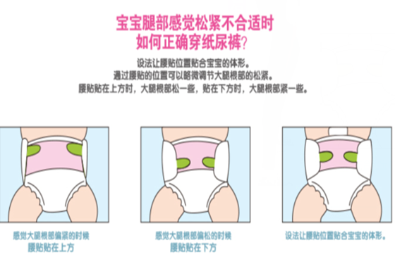 3、要把腰部和大腿根内侧纸尿裤的边拉出并抚平,否则会勒宝宝的大腿根,还会导致大腿根不透气被汗浸和漏尿。 4、平整大腿根一圈的纸尿裤,纸尿裤一般边的两圈是有弹性的防漏边的,要整理好内侧,不要歪掉勒住宝宝的生殖器,同时还要确保外层的边要拉出来,如果外层边掖进腿里的话,肯定漏尿的。 5、要注意大腿的松紧程度,太松会漏尿,如果纸尿裤太大的话,就要把腰扣往下方扣并且要缩小腿围避免漏尿。 本文来自大风号,仅代表大风号自媒体观点。