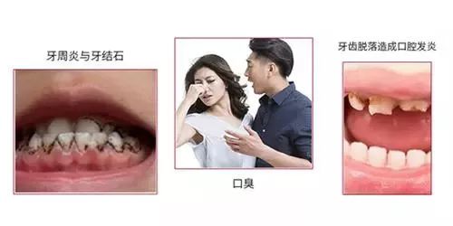 5D1304B83093BFD155DAB380DC9188D28B91808D_size15_w500_h250.jpeg