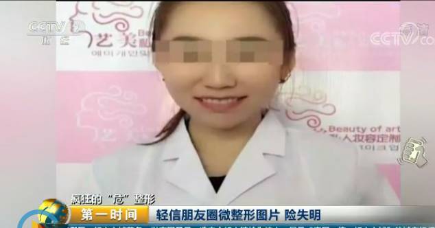 央视曝光微整形乱象:“医生”用鸡腿练手 3天上岗