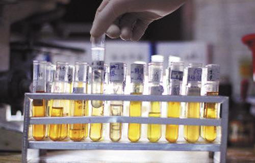 排尿很黄,异味很大,暗示身体得了什么病?