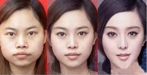 盘点娱乐圈整容失败的明星,个个让人不忍直视!