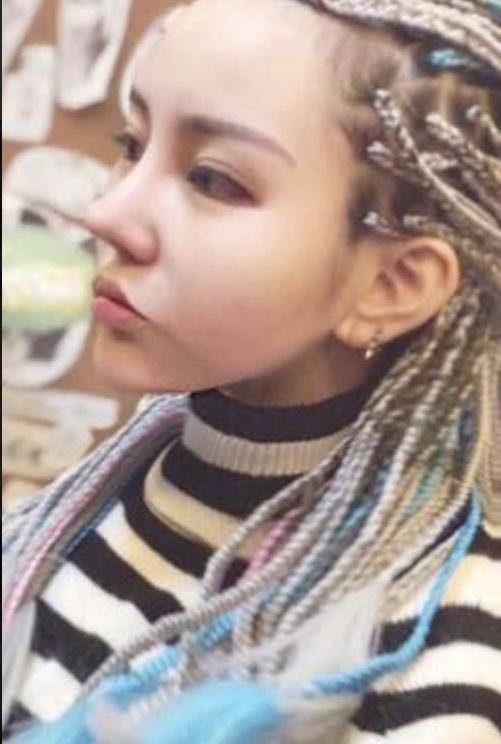 盘点娱乐圈整容失败的明星,个个让人不忍直视!