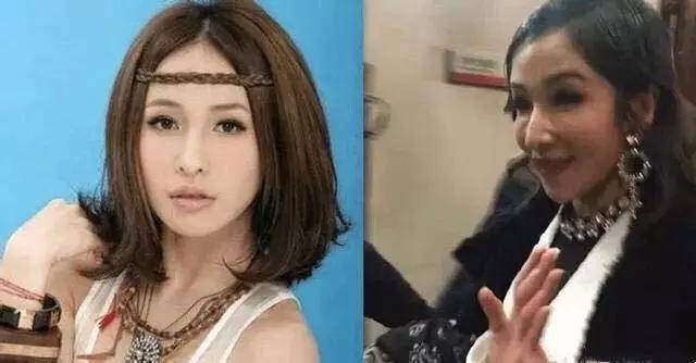 盘点娱乐圈整容失败的明星,个个让人不忍直视!