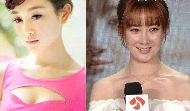 盘点娱乐圈整容失败的明星,个个让人不忍直视!