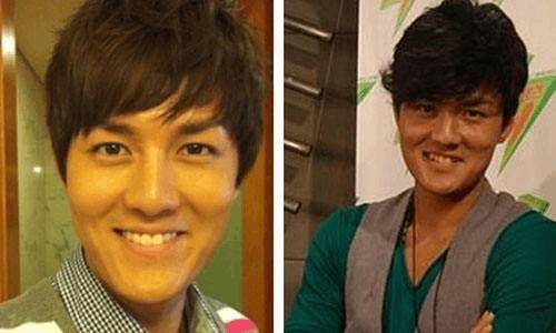 盘点娱乐圈整容失败的明星,个个让人不忍直视!