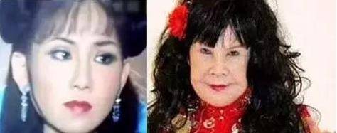 盘点娱乐圈整容失败的明星,个个让人不忍直视!