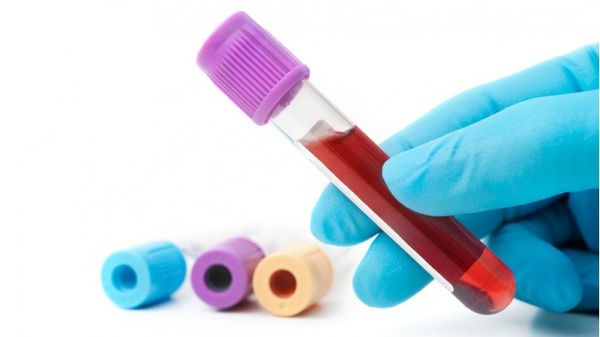 科学家找到一种能检测八种癌症的血液测试