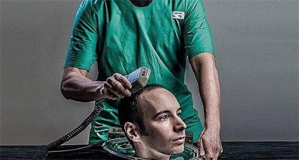 许多科学家质疑，是否有先进的医学技术支持卡纳维罗在明年秋季完成人类头部移植手术，但是卡纳维罗声称自己会这么做。