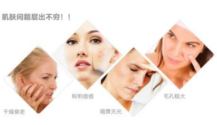 怎样快速解决脸上皱纹 1FC02366338F916D7D847E2CA65A7A4CCCAB2B69_size21_w716_h412.jpeg