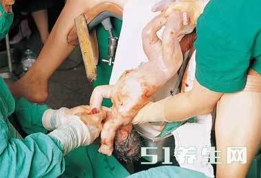 图解真实自然分娩全过程，胆小者勿入！_图5
