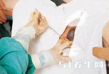 图解真实自然分娩全过程，胆小者勿入！_图2