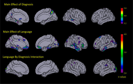 研究称掌握多种语言可能有助于挽救你的大脑