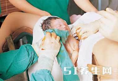 图解真实自然分娩全过程，胆小者勿入！_图4