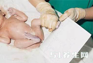 图解真实自然分娩全过程，胆小者勿入！_图10
