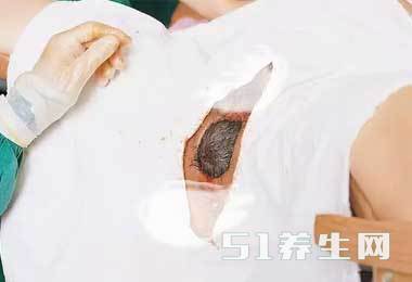 图解真实自然分娩全过程，胆小者勿入！_图1