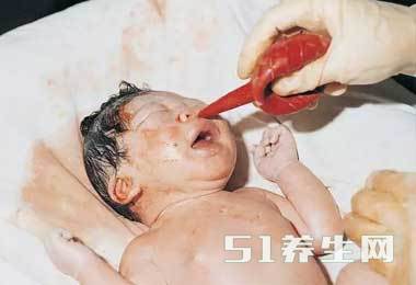 图解真实自然分娩全过程，胆小者勿入！_图8