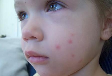 医生绝不会告诉你这种药膏才几毛钱,但功能却