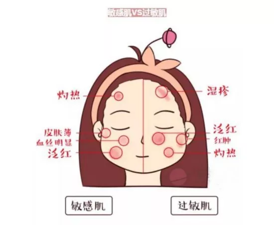 强生双周怎么保养,强生双周抛好不好
