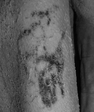距今5000年埃及木乃伊身上，科研人员发现有多处纹身