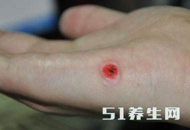 几元一瓶的风油精,没想到有这么多妙用,太实用,家家户户都需要_图3 几元一瓶的风油精,没想到有这么多妙用,太实用,家家户户都需要_图3
