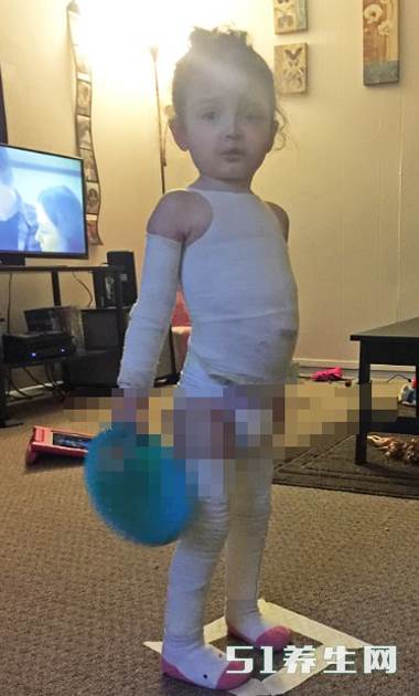 现实版的木乃伊!3岁女童抚摸都会有生命危险_图5 现实版的木乃伊!3岁女童抚摸都会有生命危险_图5