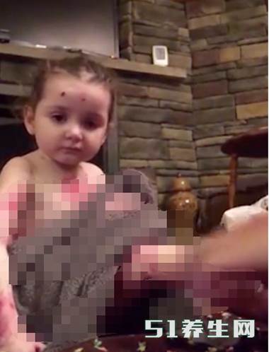 现实版的木乃伊!3岁女童抚摸都会有生命危险_图3 现实版的木乃伊!3岁女童抚摸都会有生命危险_图3