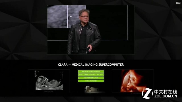 医疗领域大突破 NVIDIA黑科技助力3D成像