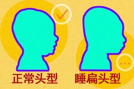 我妈把我睡成了扁头,还很得意