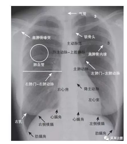 图2-1显示x线正位胸片可见的一些正常的解剖特征.