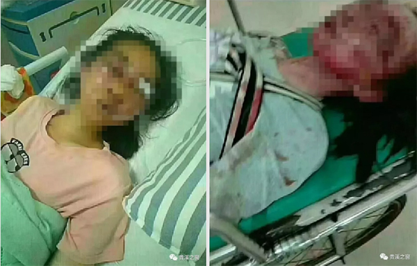 江西贵溪警方：男子殴打14岁陌生女孩致住院，被刑拘