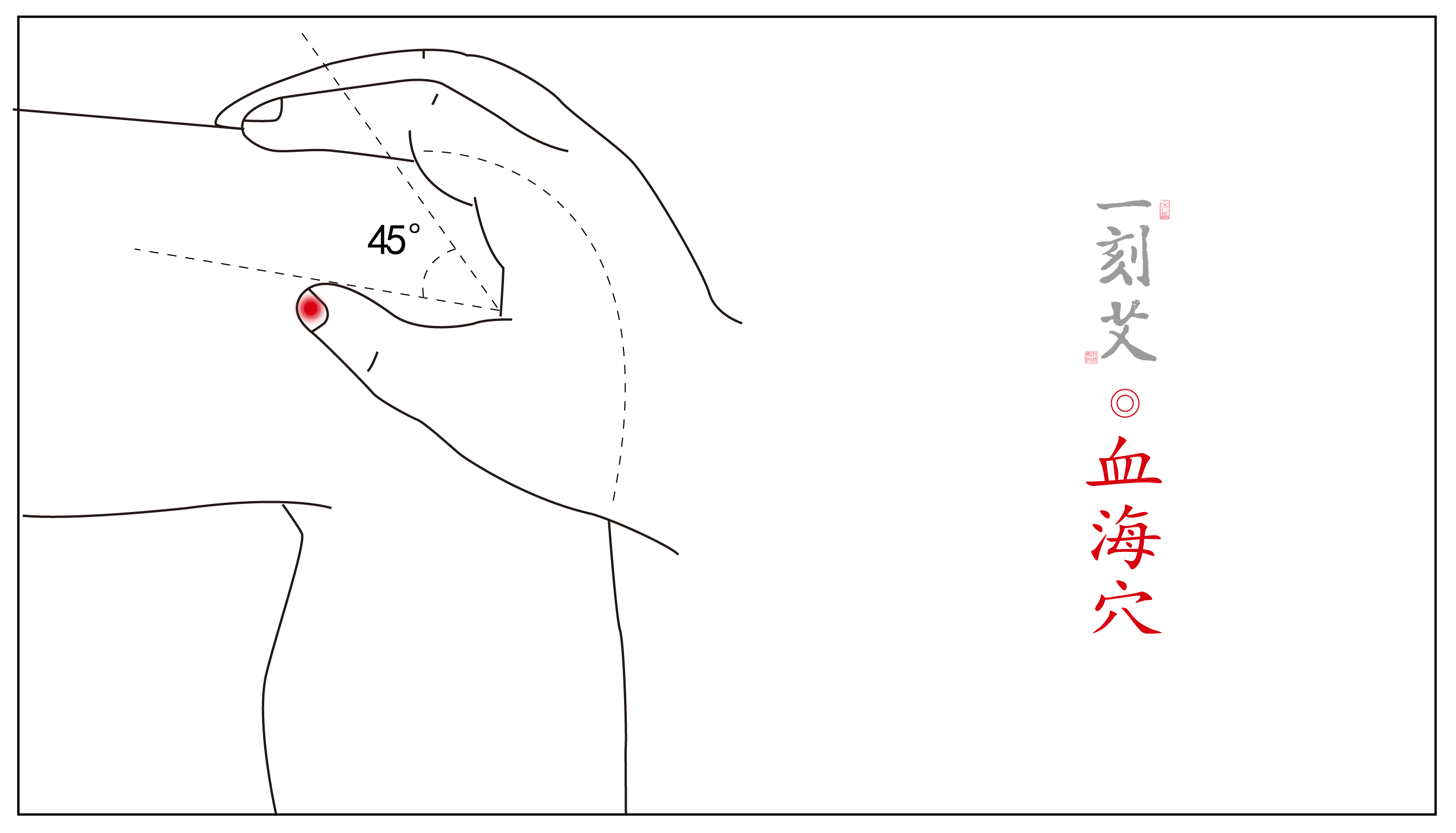 对症下灸丨崩漏的艾灸疗法