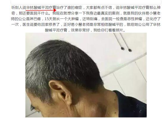 问答 | 国睿华安、小蜜桃、华林酸碱平靠谱吗?