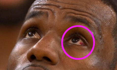 G1争议一刻:格林抠詹姆斯眼细节图曝光,这动作