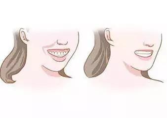 牙齿矫正能改变脸型?牙齿对脸型的影响竟然这
