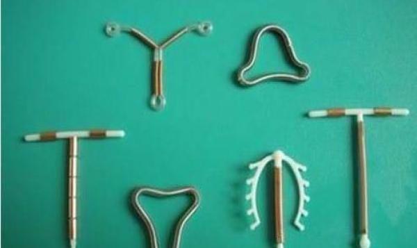 选择上环避孕真的不好吗?上环对女人意味