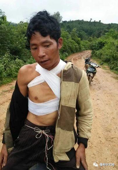 缅甸又发战事，炸弹落入贵慨村寨，致1死7伤