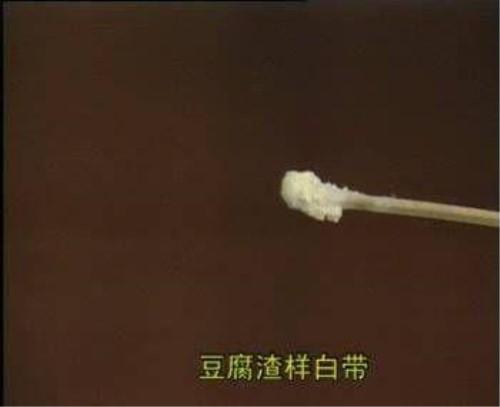 3.蛋清像豆腐渣正常的烤羊像白带一样透明,黏稠.菏泽鞑子白带腿图片