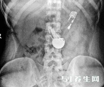 片子