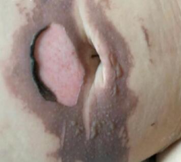 1ͯĶƤˡ ݳ˵4ǧ