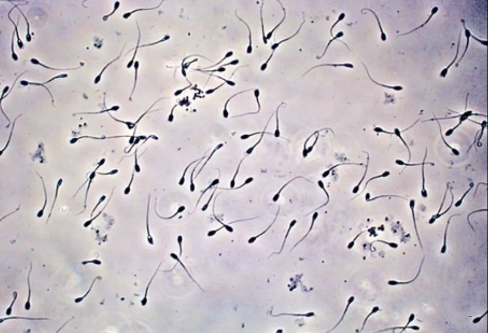 精子—像一支军队那样战斗