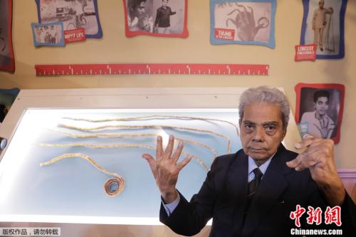 留了66年、总长超9米：印度男子终于剪掉指甲(图)
