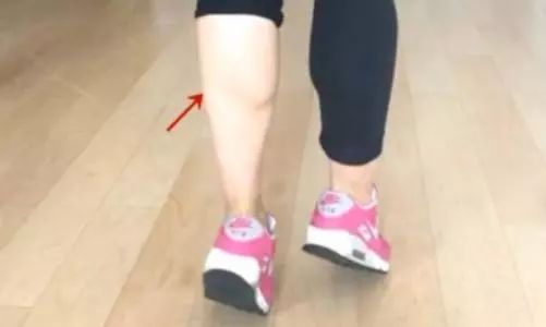敢露额头才是真女神 额头上长痘痘怎么办