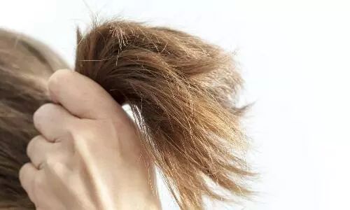 拯救你的发际线,用它按摩头皮,头发越来越多重