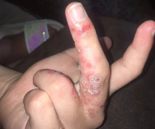 梦幻多彩的“网红泥”，差点要了孩子的命！