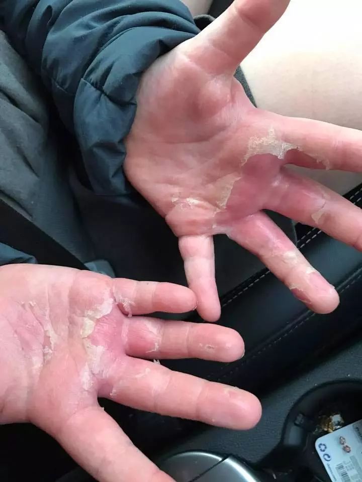 梦幻多彩的“网红泥”，差点要了孩子的命！