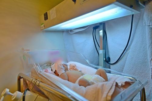 台湾婴儿胆红素飙升变成“黄宝宝” 紧急换血治好