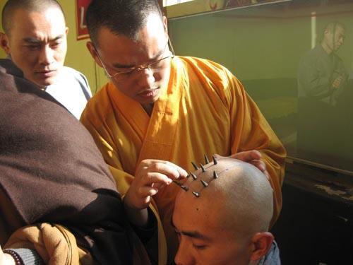 前列腺炎号称永远不能痊愈,你禁欲四个月就想