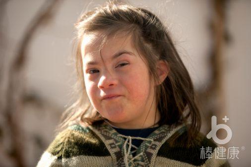 听说患唐氏综合征的男性没有生育能力?那女性