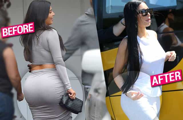 kim-kardashian-plastic-surgery-before-and-after-boobs-pictures-7